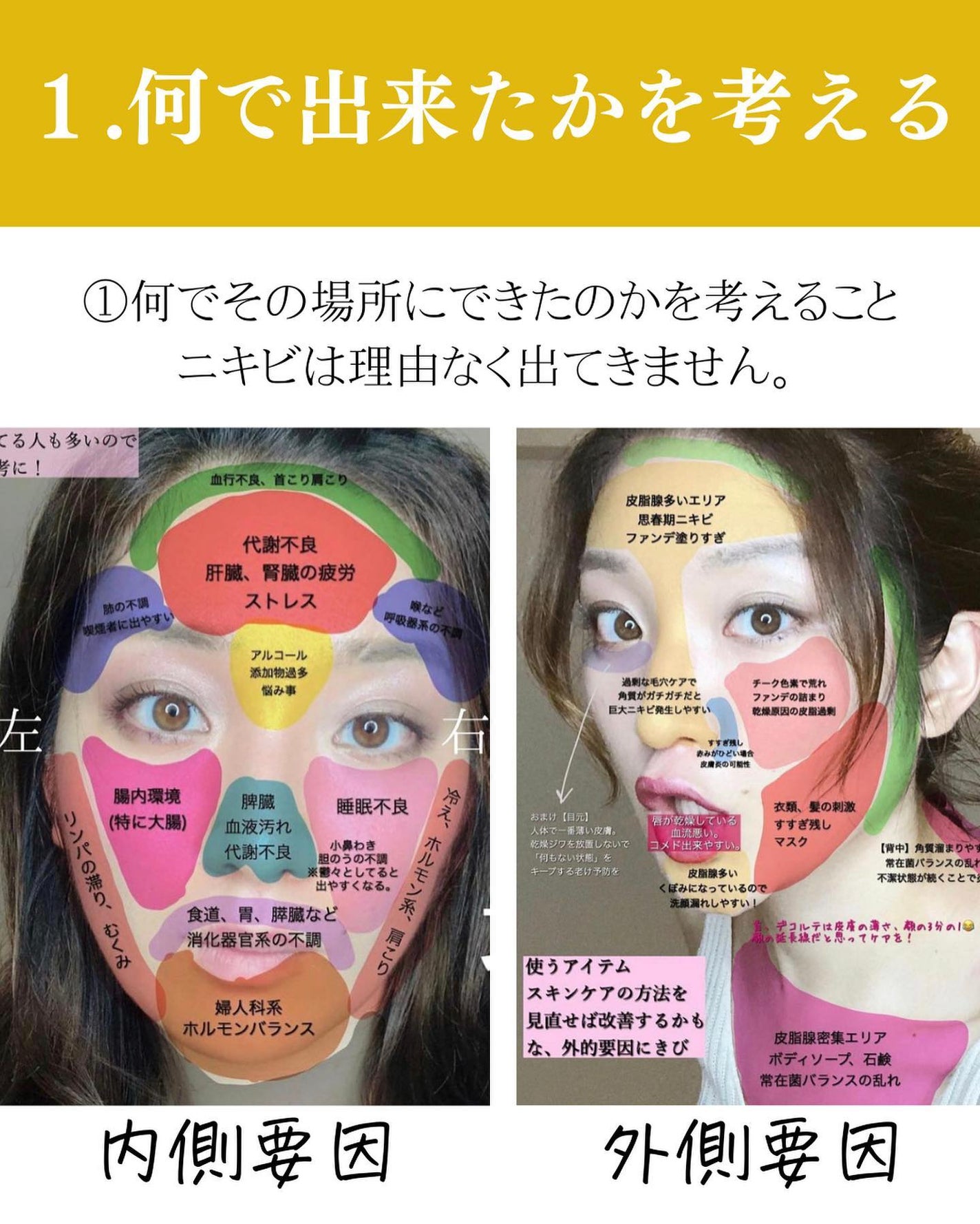 おゆみ|ニキビ・ニキビ跡ケア on LIPS 「@______ohyoume◀︎他の投稿はこちらから💄【ニキビ..」(3枚目)