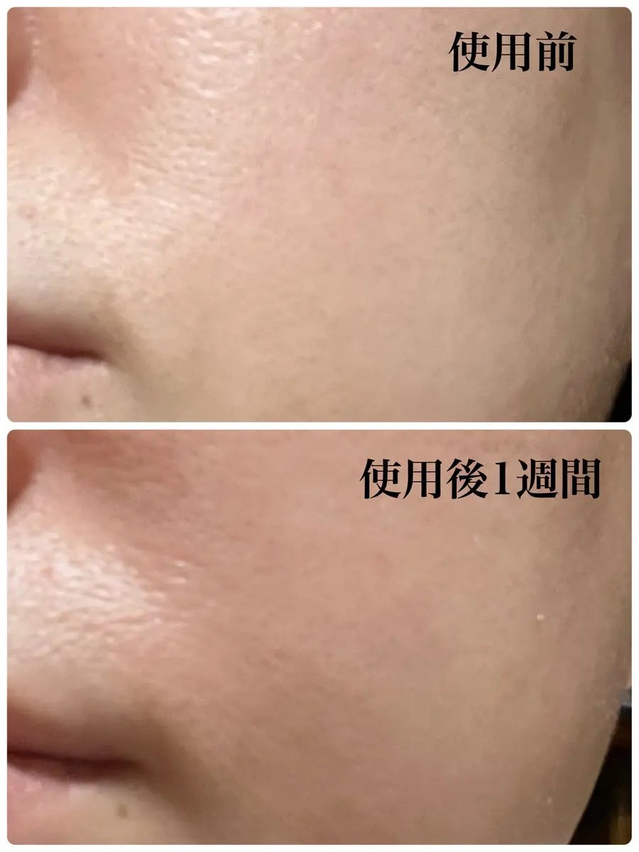 パンテショット675/COSNORI/美容液を使ったクチコミ(2枚目)