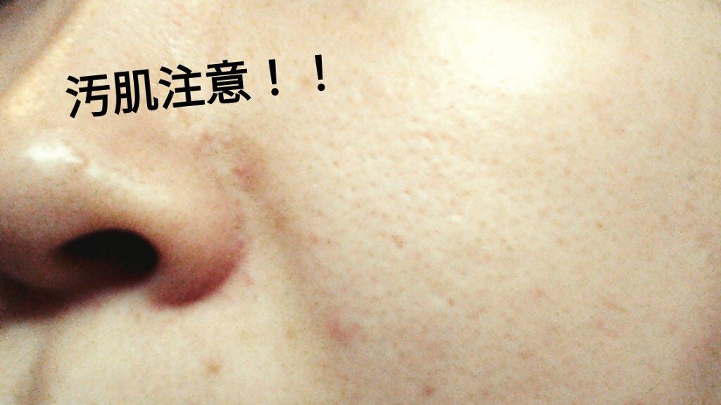 ハトムギ化粧水(ナチュリエ スキンコンディショナー R )/ナチュリエ/化粧水を使ったクチコミ(1枚目)