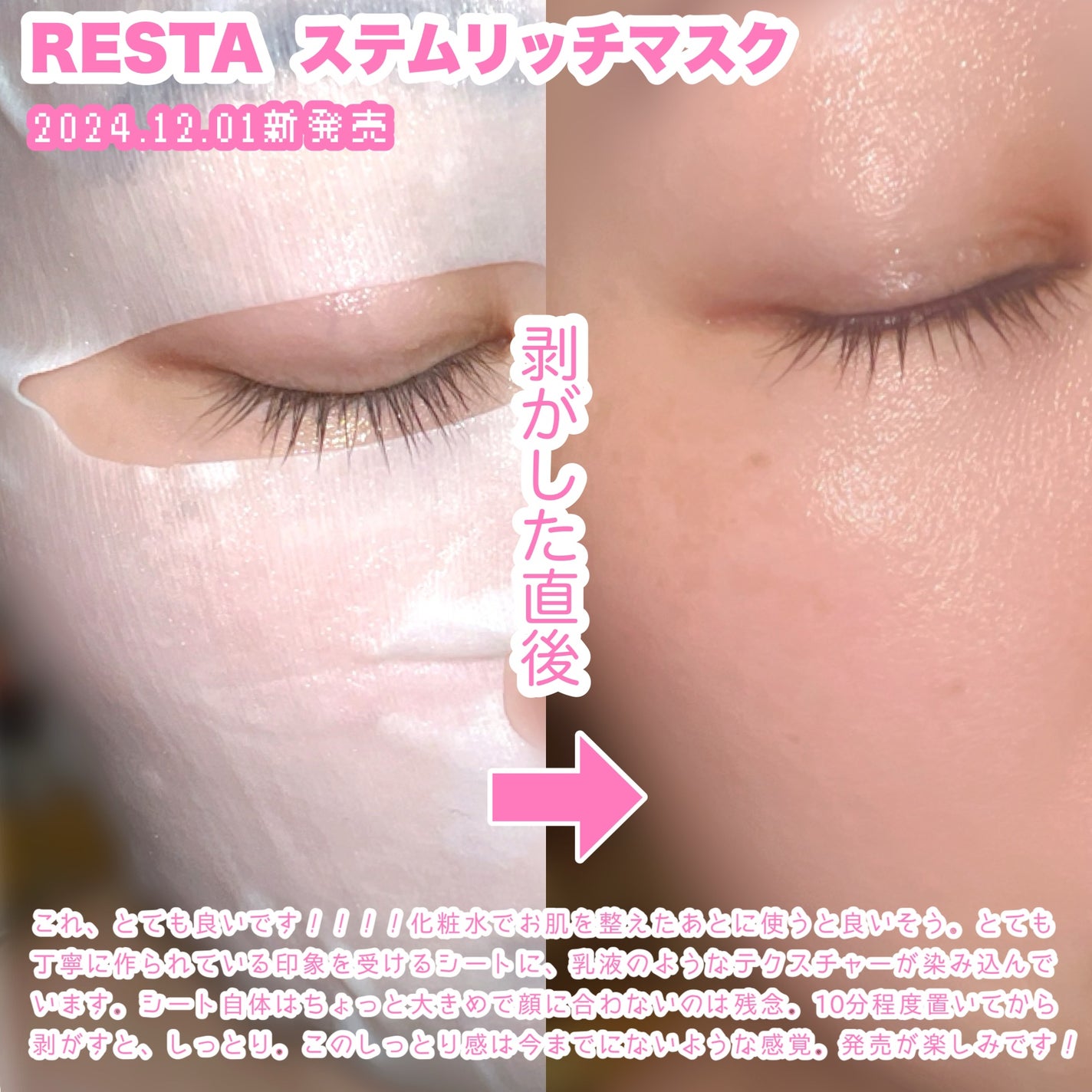 ステムリッチクリーム/リスタ/フェイスクリームを使ったクチコミ(4枚目)