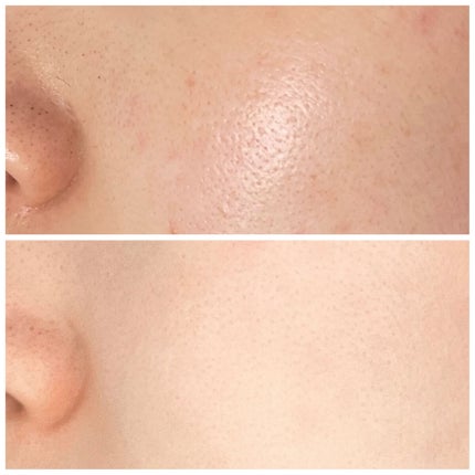 RXザ・ビタミンC23セラム/COSRX/美容液を使ったクチコミ(5枚目)