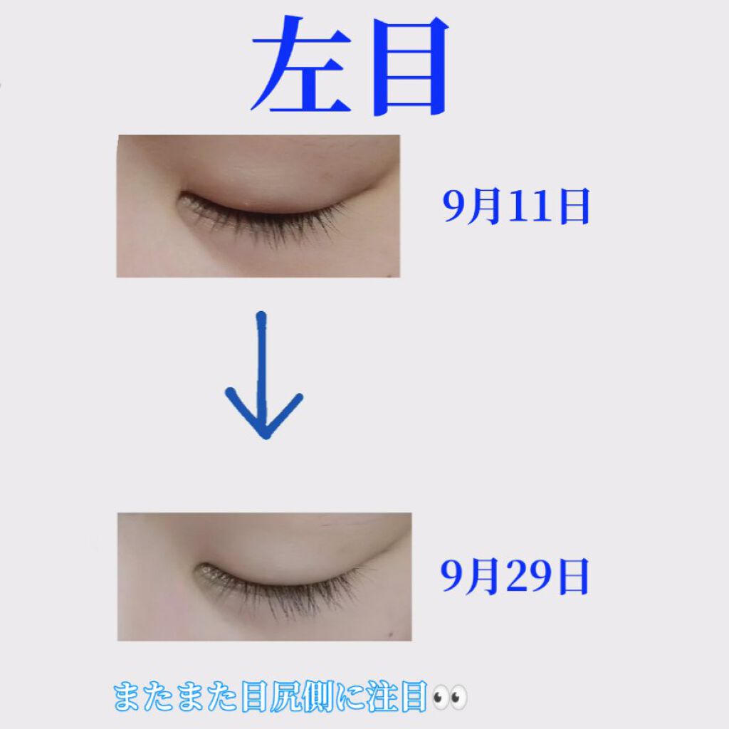 まつげ美容液EX/CEZANNE/まつげ美容液を使ったクチコミ（3枚目）