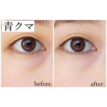 ミネラルコンシーラーパレット/エトヴォス/パレットコンシーラーを使ったクチコミ(4枚目)