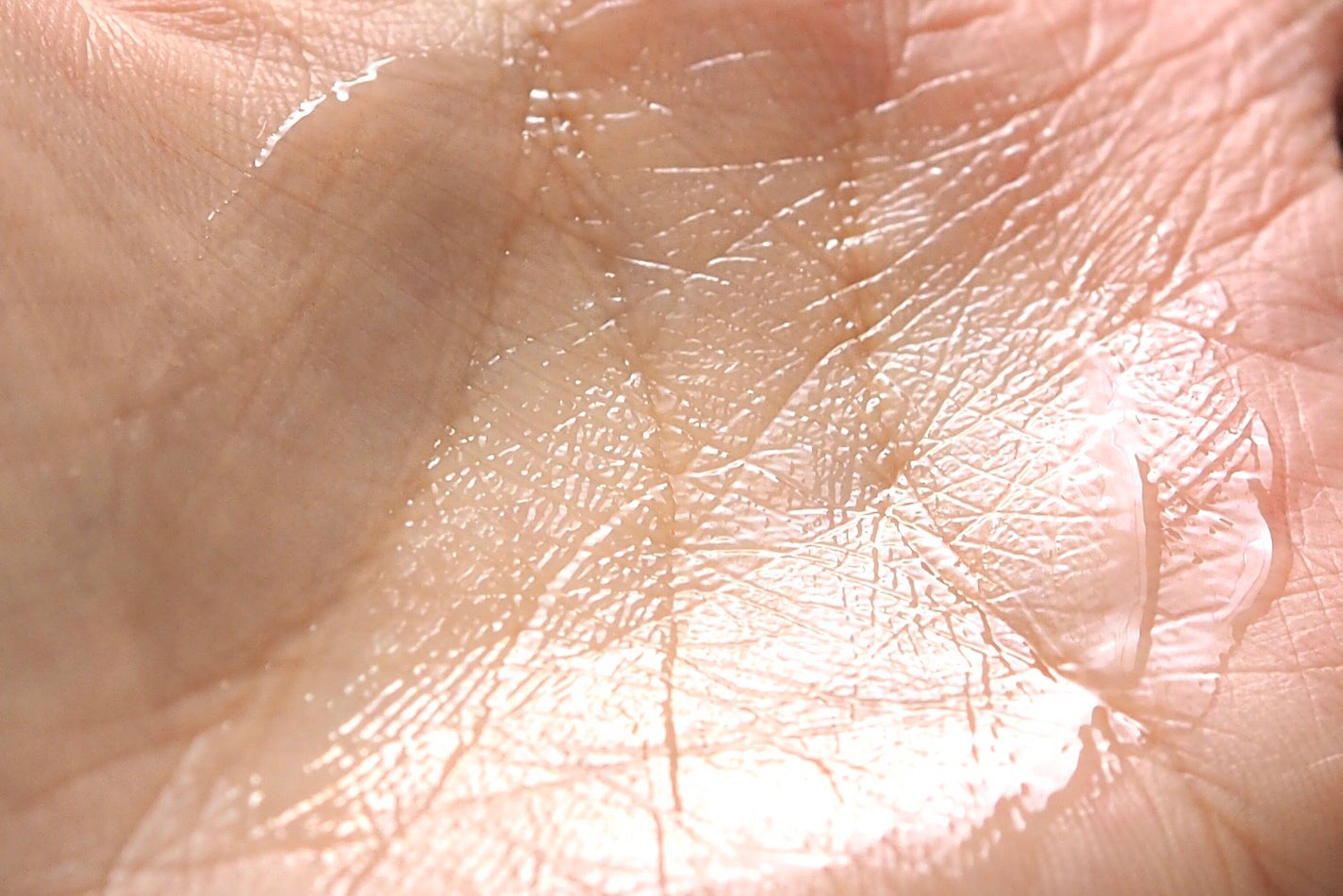 Dr.ウィラード・スキンジェル/Dr.ウィラード・ウォーター/美容液を使ったクチコミ(5枚目)