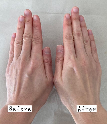 パーフェクトワン 薬用ホワイトニングジェル/パーフェクトワン/オールインワン化粧品を使ったクチコミ(4枚目)