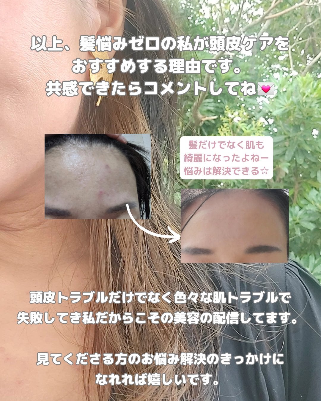 美肌カウンセラー💆肌悩みを解決し見る世界を変える on LIPS 「20年間やらずに損した😢😭垢抜け、まゆ毛メイク1選本当に本当に..」(8枚目)