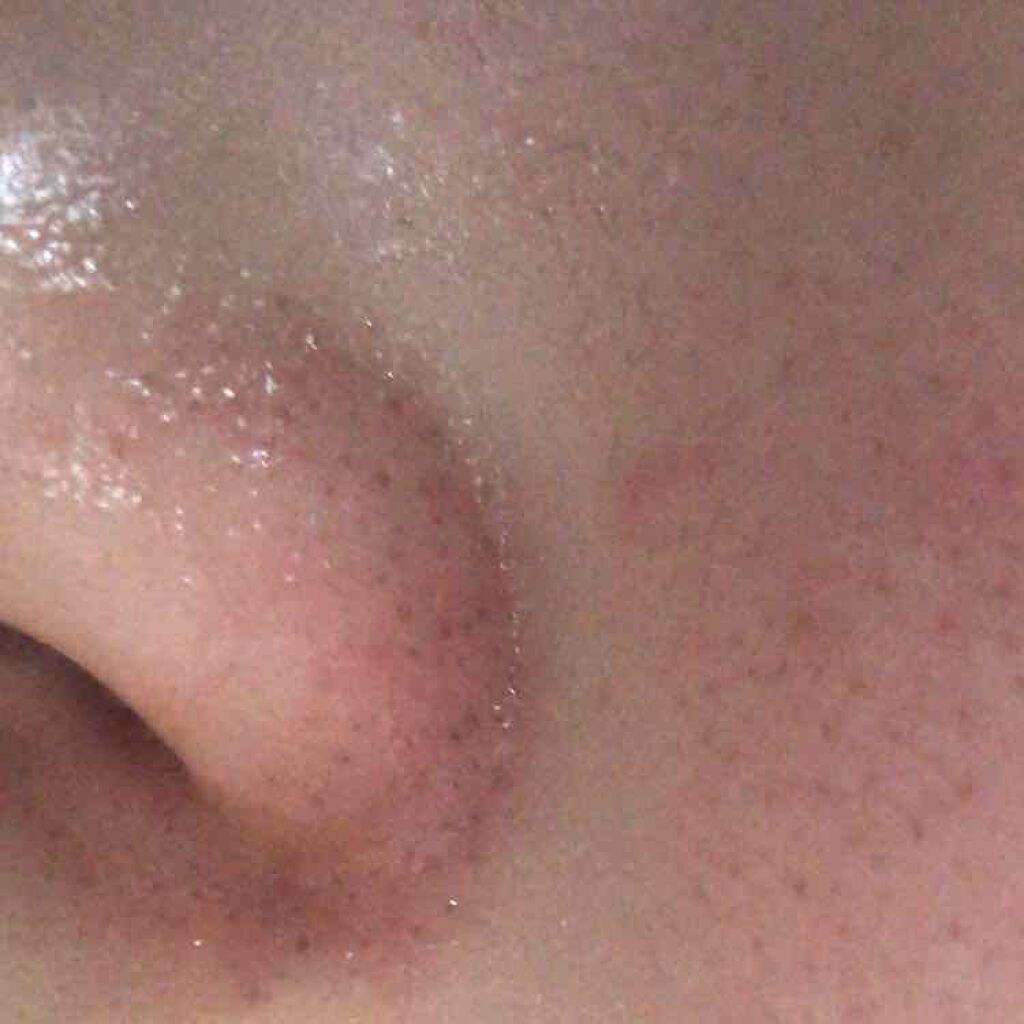 ハトムギ保湿ジェル(ナチュリエ スキンコンディショニングジェル)/ナチュリエ/美容液を使ったクチコミ（3枚目）