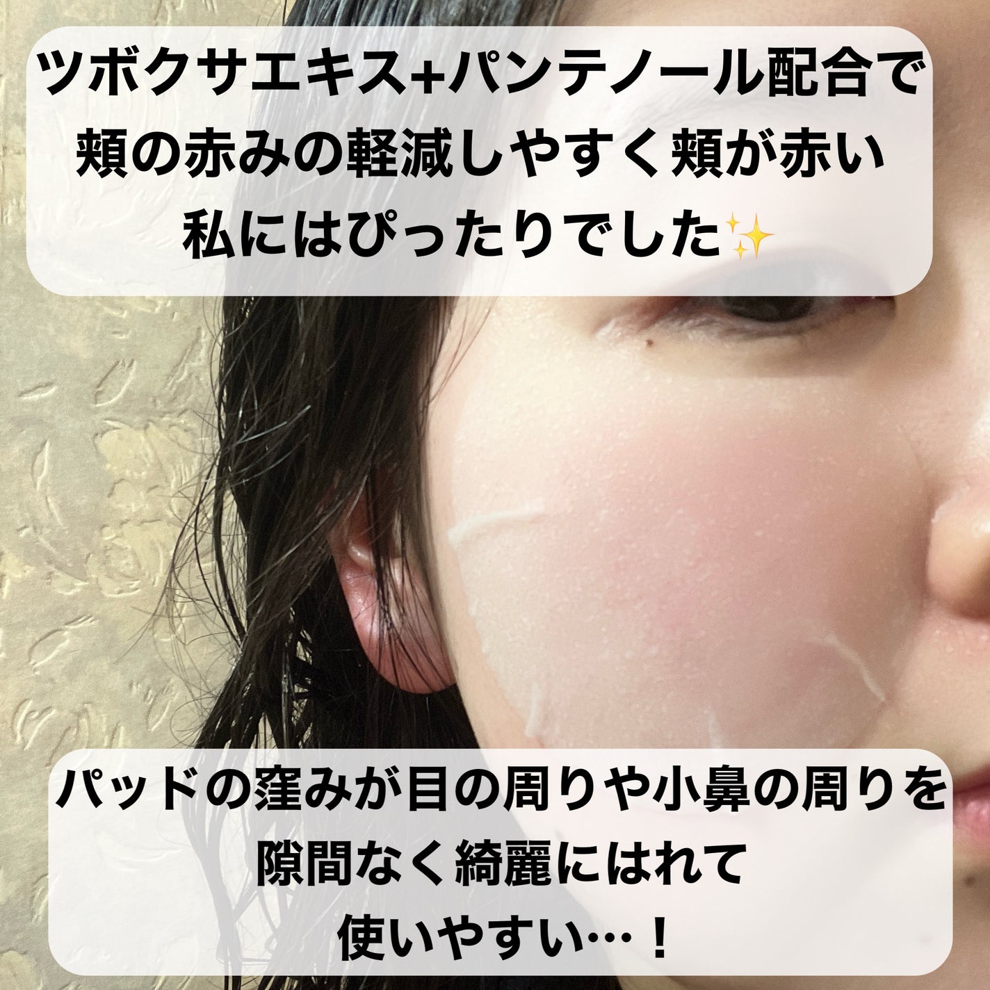 センテラ クイックカーミングパッド/SKIN1004/トナーパッドを使ったクチコミ(4枚目)