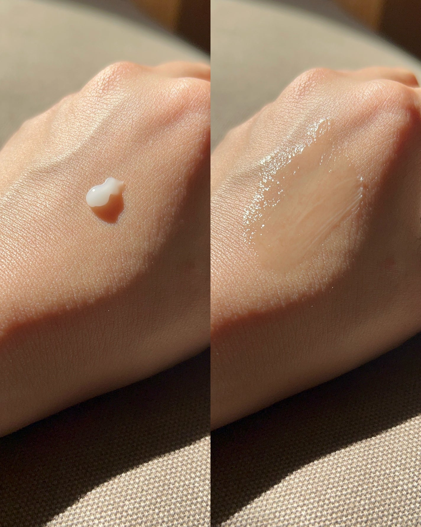 シカスポットクリーム/NATURAL DERMA PROJECT/フェイスクリームを使ったクチコミ(5枚目)