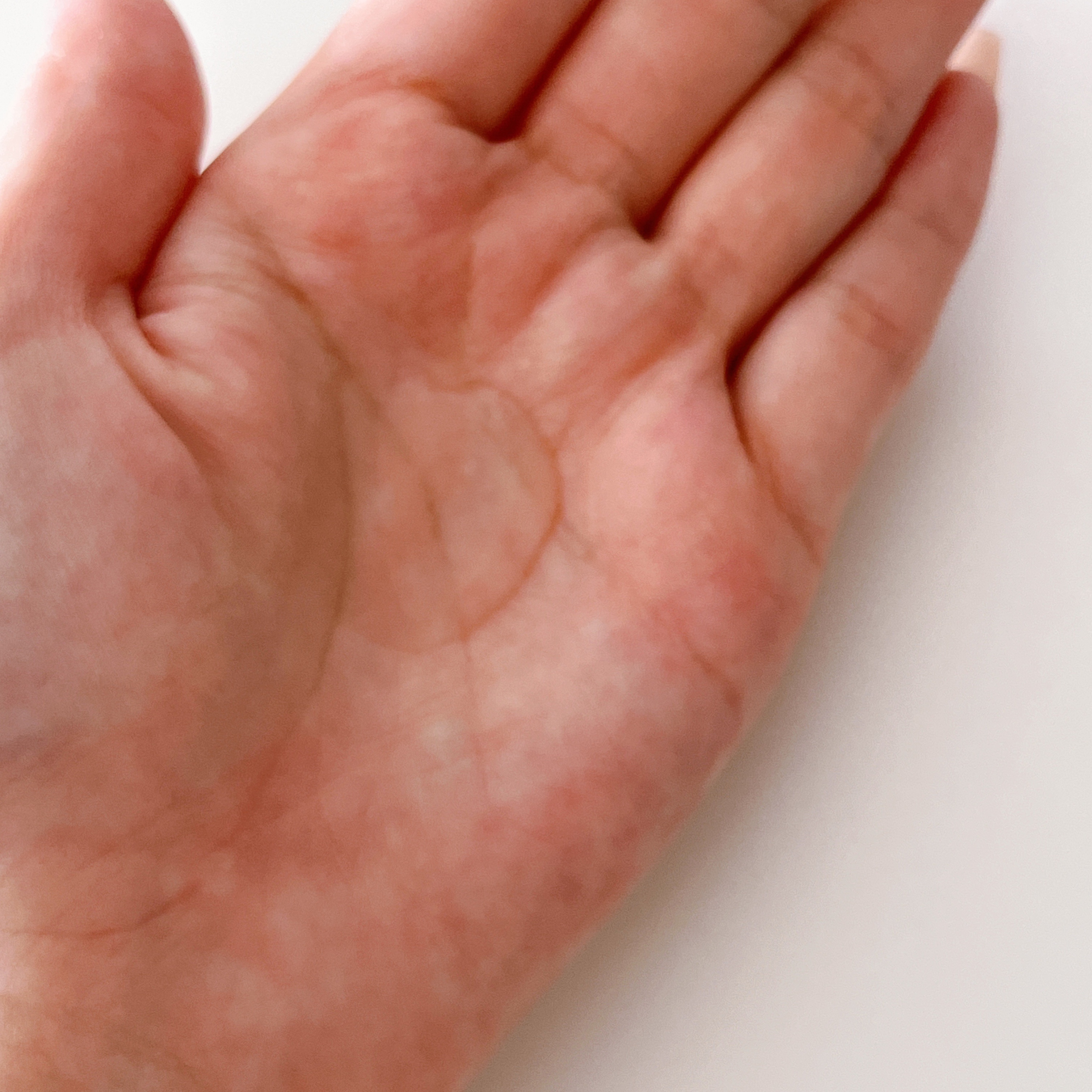 Dr.G Dermoisture Barrier.D/Dr.G/化粧水を使ったクチコミ（3枚目）