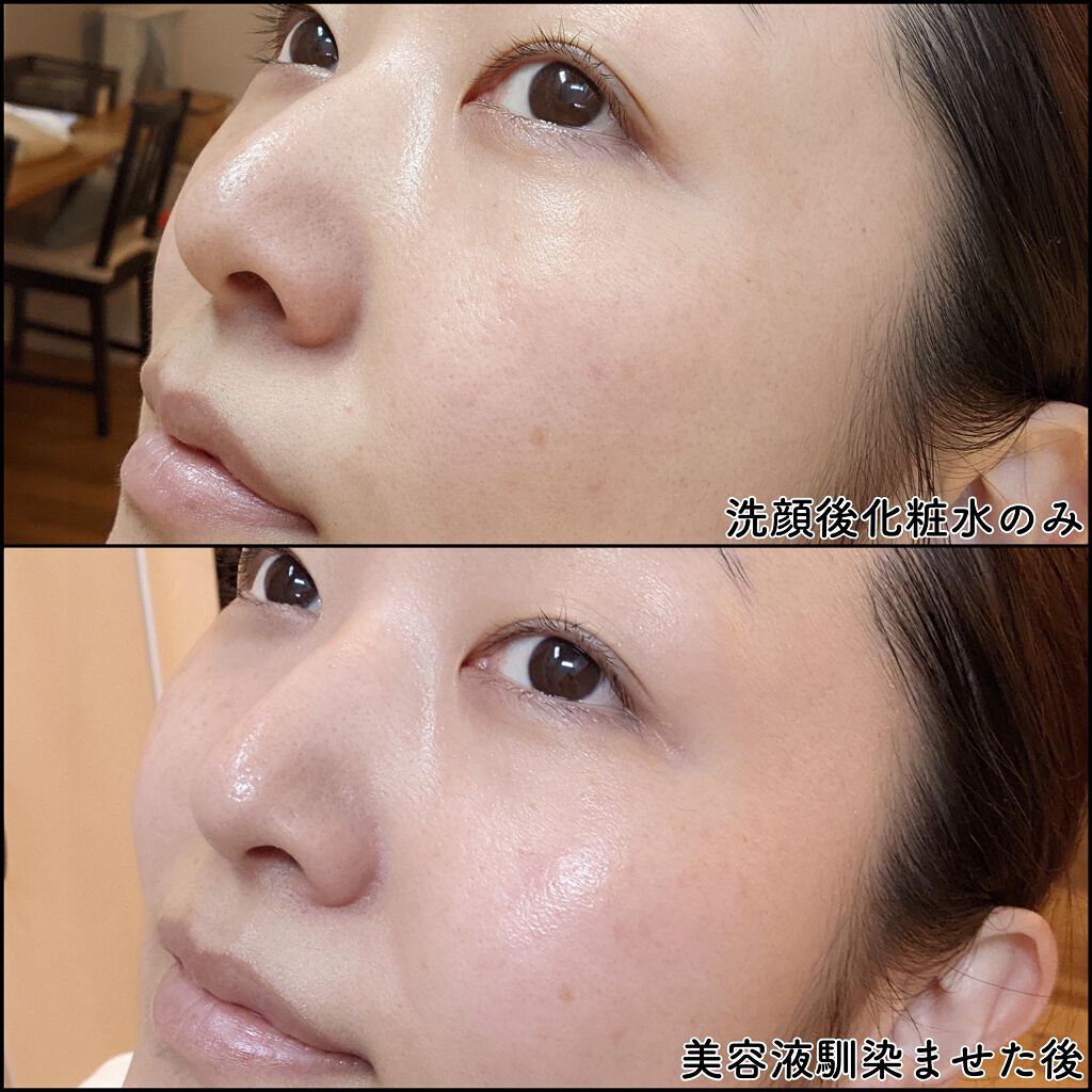 センテラ アンプル/SKIN1004/美容液を使ったクチコミ(6枚目)