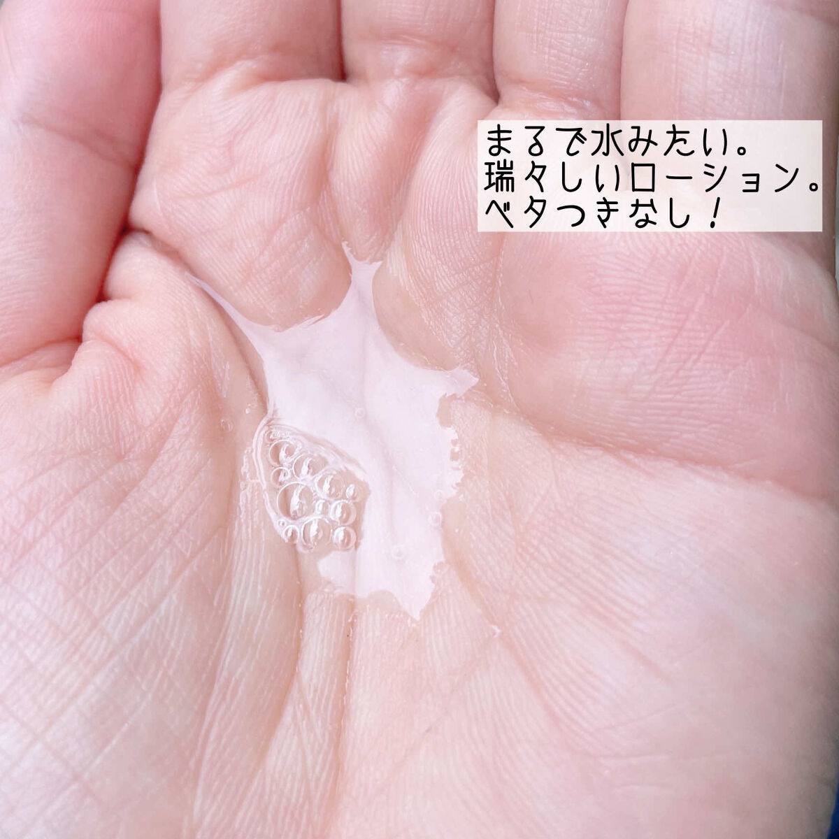 ミノン アミノモイスト 薬用アクネケア ローション/ミノン/化粧水を使ったクチコミ（2枚目）