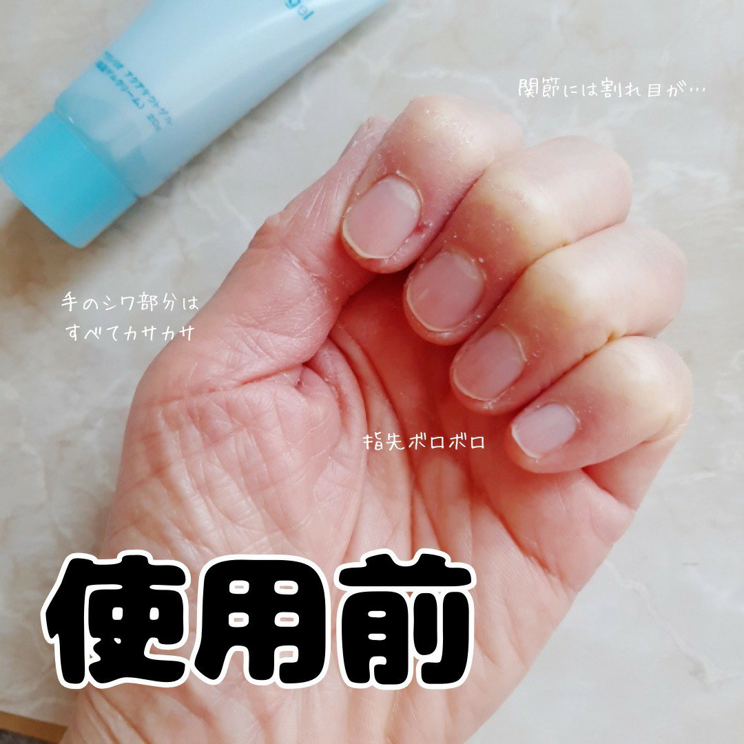 アクアテクトゲル/アクシリオ/オールインワン化粧品を使ったクチコミ（3枚目）