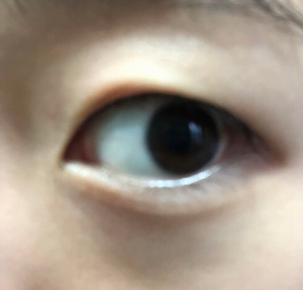 ふたえテープ 目立たず肌になじむ絆創膏タイプ/DAISO/二重まぶた用アイテムを使ったクチコミ(2枚目)