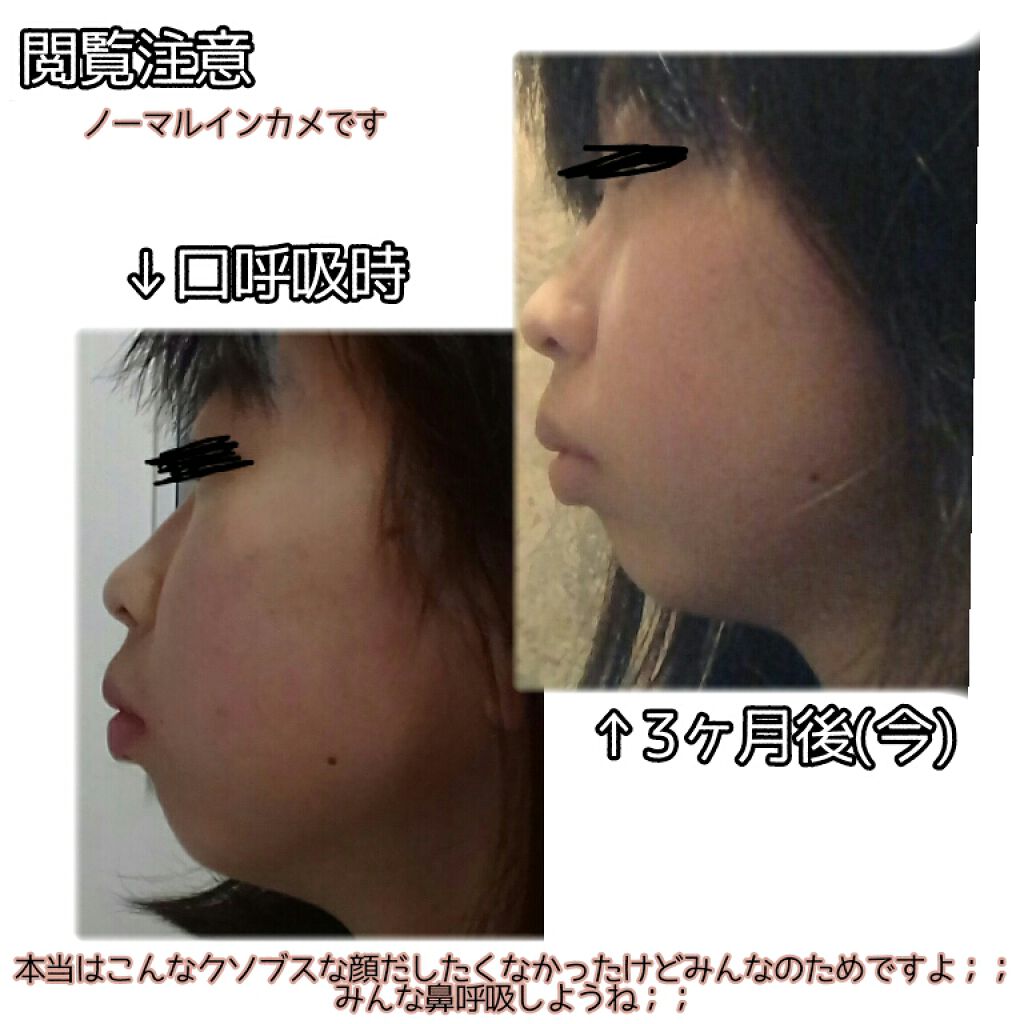 安眠マウステープ/DAISO/その他を使ったクチコミ（3枚目）