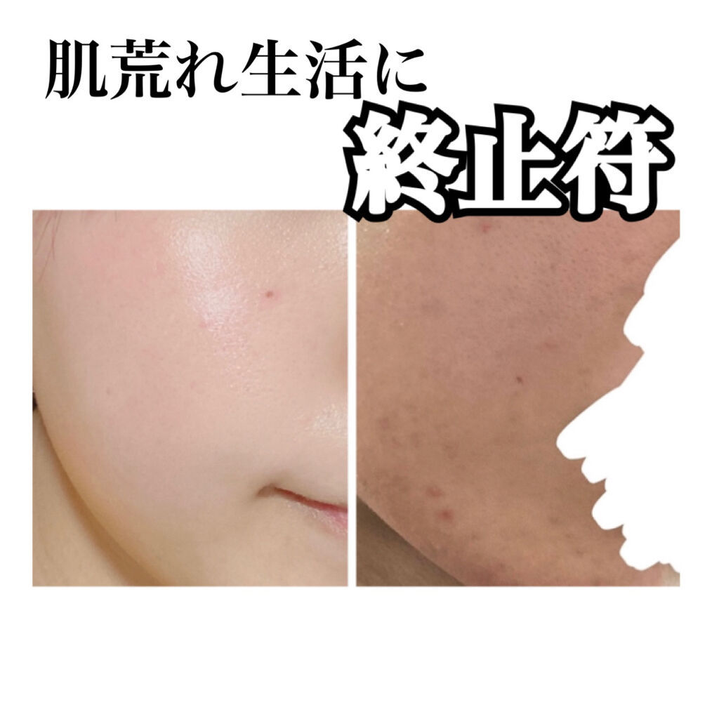 レチノールA 1% アドバンスドリバイタリゼーションクリーム/Life-flo/フェイスクリームを使ったクチコミ（1枚目）