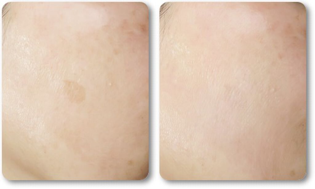 ホワイトカバースティック/shimaboshi/スティックコンシーラーを使ったクチコミ(1枚目)