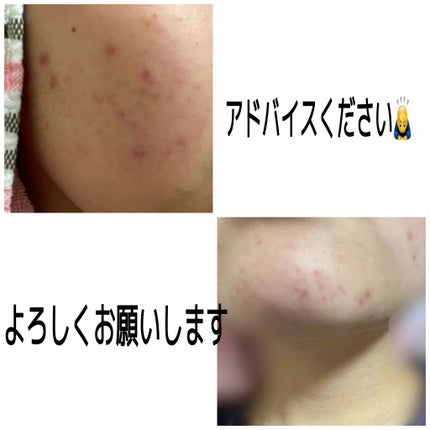 を使ったクチコミ(2枚目)