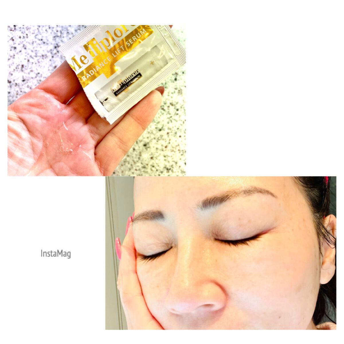 メディプローラー CO2ジェルマスク/ドクターメディオン/洗い流すパック・マスクを使ったクチコミ(3枚目)