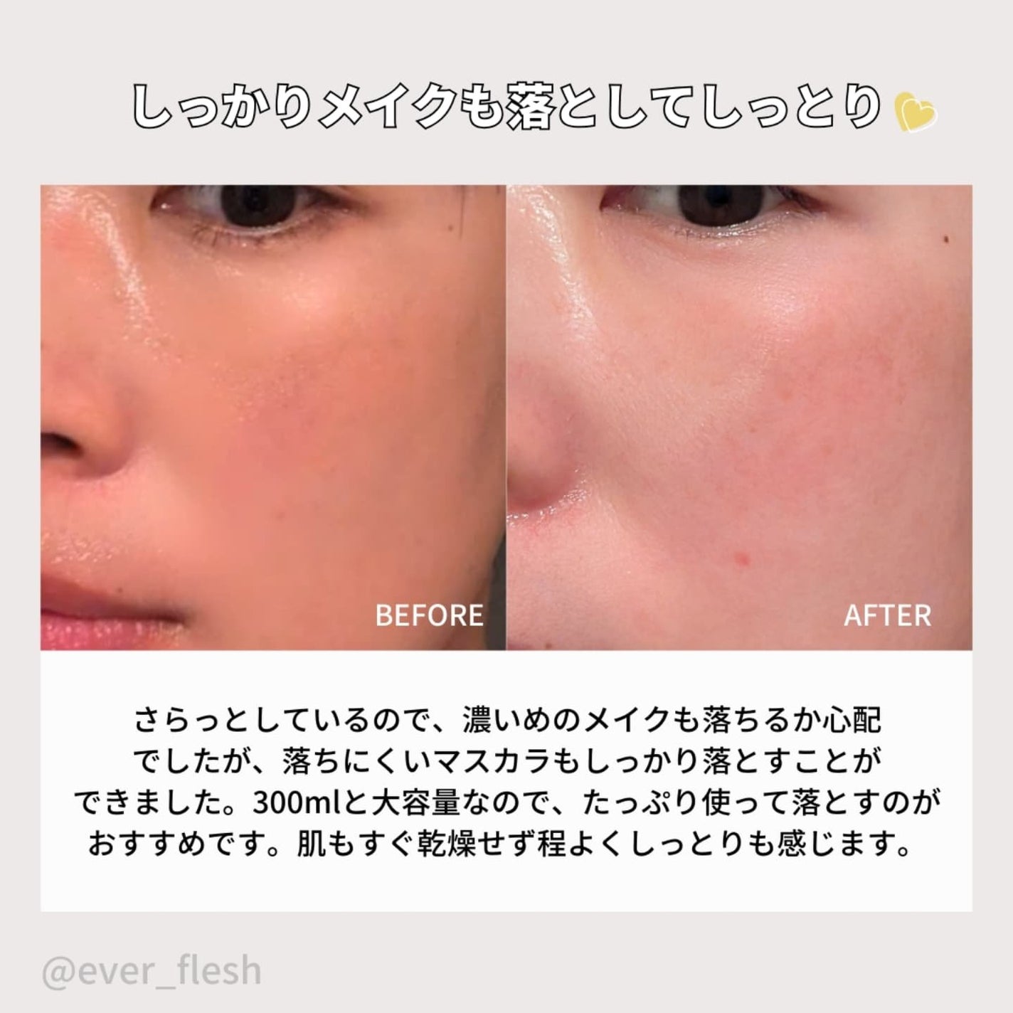 ブレミッシュクレンジングオイル/PAPA RECIPE/オイルクレンジングを使ったクチコミ(5枚目)