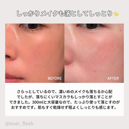 ブレミッシュクレンジングオイル/PAPA RECIPE/オイルクレンジングを使ったクチコミ(5枚目)