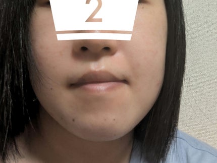 薬用しみ集中対策 プレミアム美容液/メラノCC/美容液を使ったクチコミ(2枚目)