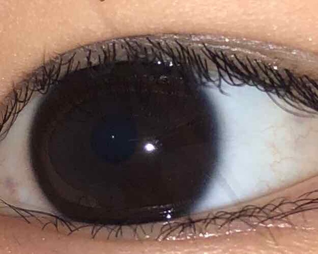 スマイルホワイティエ(医薬品)/ライオン/その他を使ったクチコミ(2枚目)