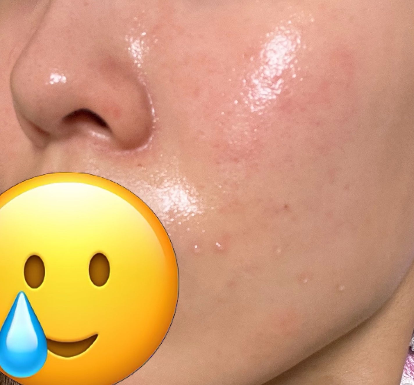 ビタペアC 集中美容液スペシャルセット/ネイチャーリパブリック/美容液を使ったクチコミ(2枚目)