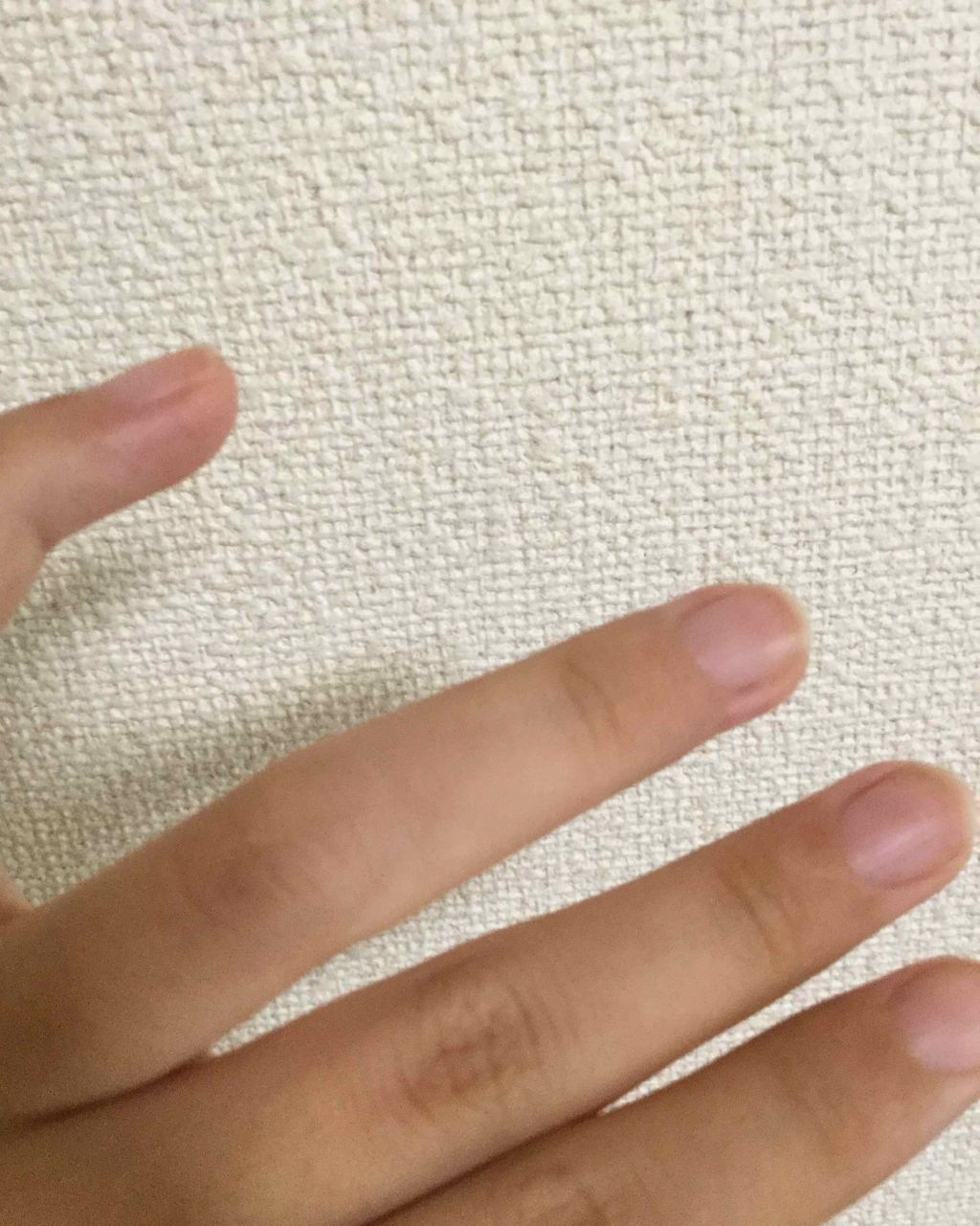 ケシミンクリーム f/ケシミン/フェイスクリームを使ったクチコミ(3枚目)