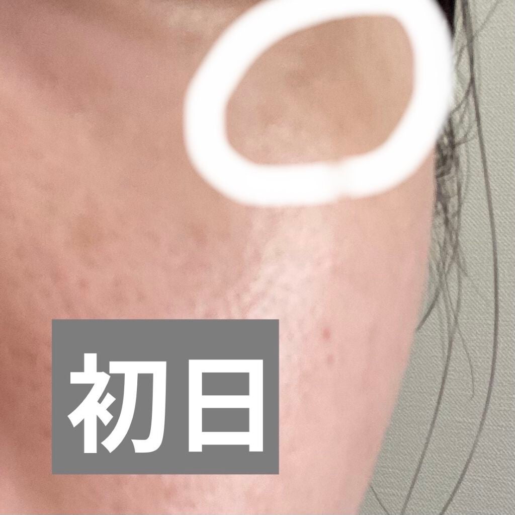 敏感肌用薬用美白美容液/無印良品/美容液を使ったクチコミ(2枚目)