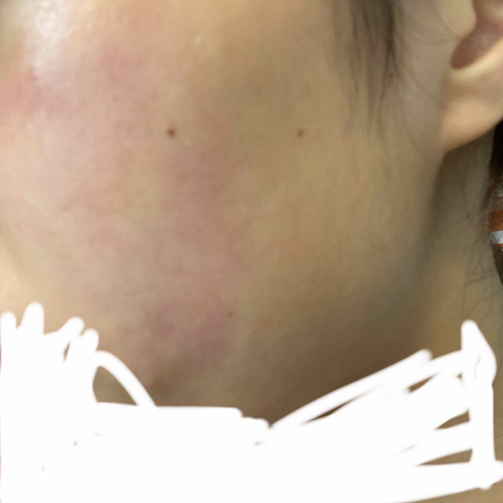 ハトムギ化粧水(ナチュリエ スキンコンディショナー R )/ナチュリエ/化粧水を使ったクチコミ（2枚目）