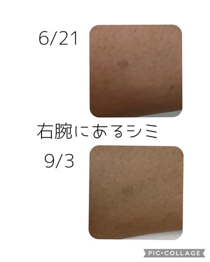 ナイアシンアミド5% ソリューション モイスチャークリーム/PETERANDLABS/フェイスクリームを使ったクチコミ(2枚目)