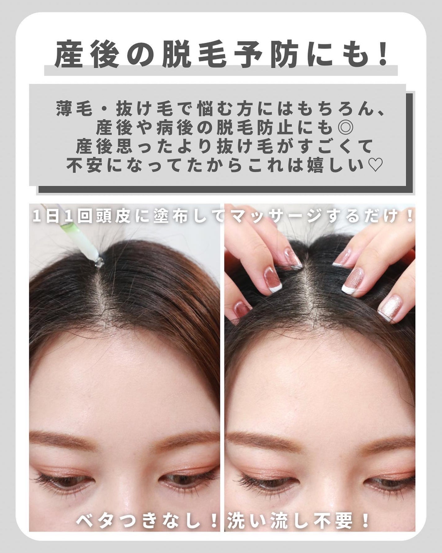 薬用 メディカル アンチヘアロスセラム/L'OCCITANE/頭皮ローションを使ったクチコミ(4枚目)