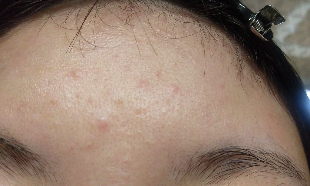 りん on LIPS 「皆さん!!助けてください!どうも、りん🌼🍨です。久しぶりの投稿..」(2枚目)