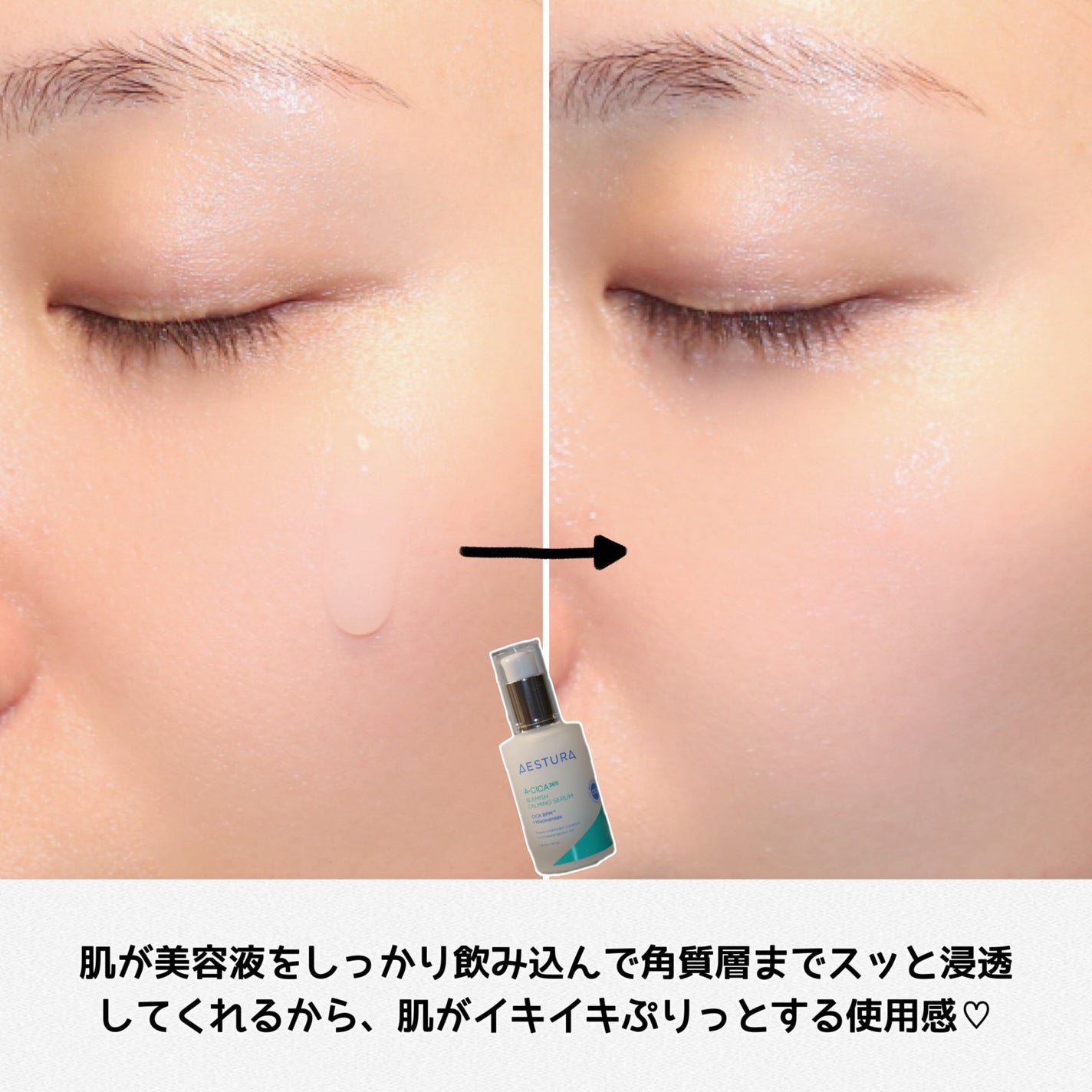 エイシカ365マイクロセラム/AESTURA/美容液を使ったクチコミ(6枚目)