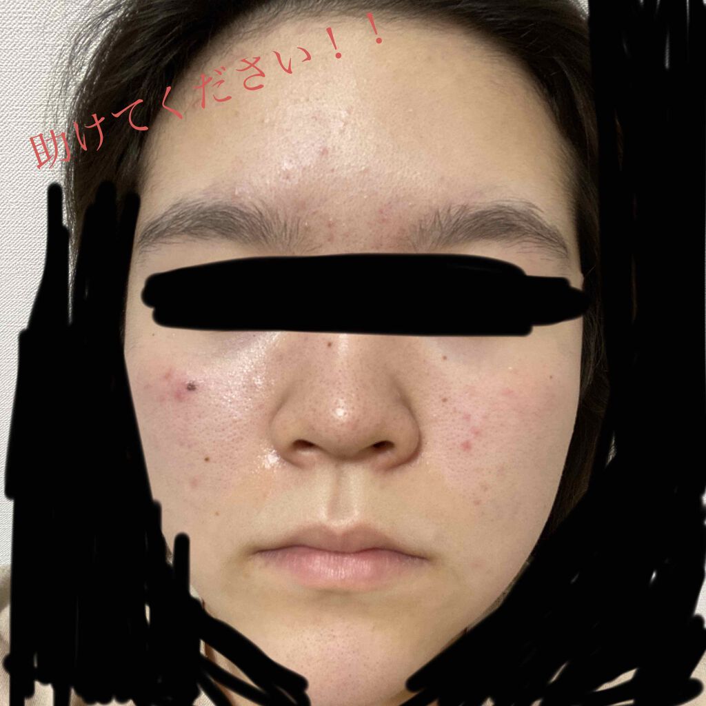 ハトムギ化粧水(ナチュリエ スキンコンディショナー R )/ナチュリエ/化粧水を使ったクチコミ(1枚目)