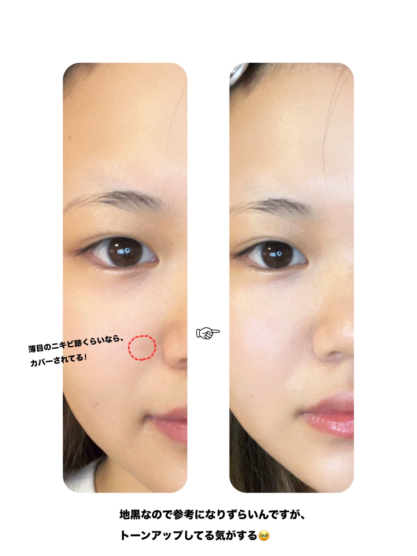 UVã€ã㢠XL ãããã¯ã·ã§ã³ããŒã³ã¢ãã ããŒãº/ã© ããã·ã¥ ããŒ/æ¥çŒãæ¢ãã¯ãªãŒã ã䜿ã£ãã¯ãã³ãïŒ2æç®ïŒ