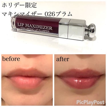 【旧】ディオール アディクト リップ マキシマイザー 026 プラム/Dior/リップグロスを使ったクチコミ（1枚目）