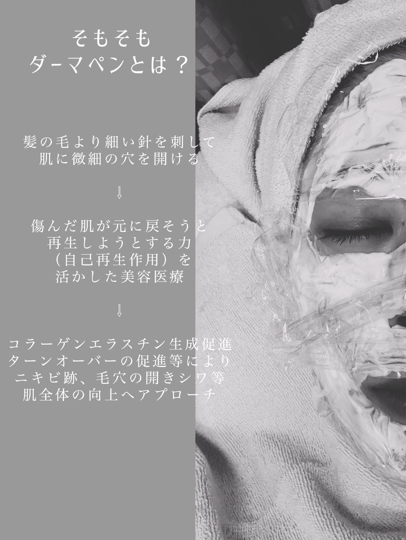 Miho on LIPS 「.#スキンケア好きな私だけど
何をやってもどう頑張っても
#鼻..」(3枚目)