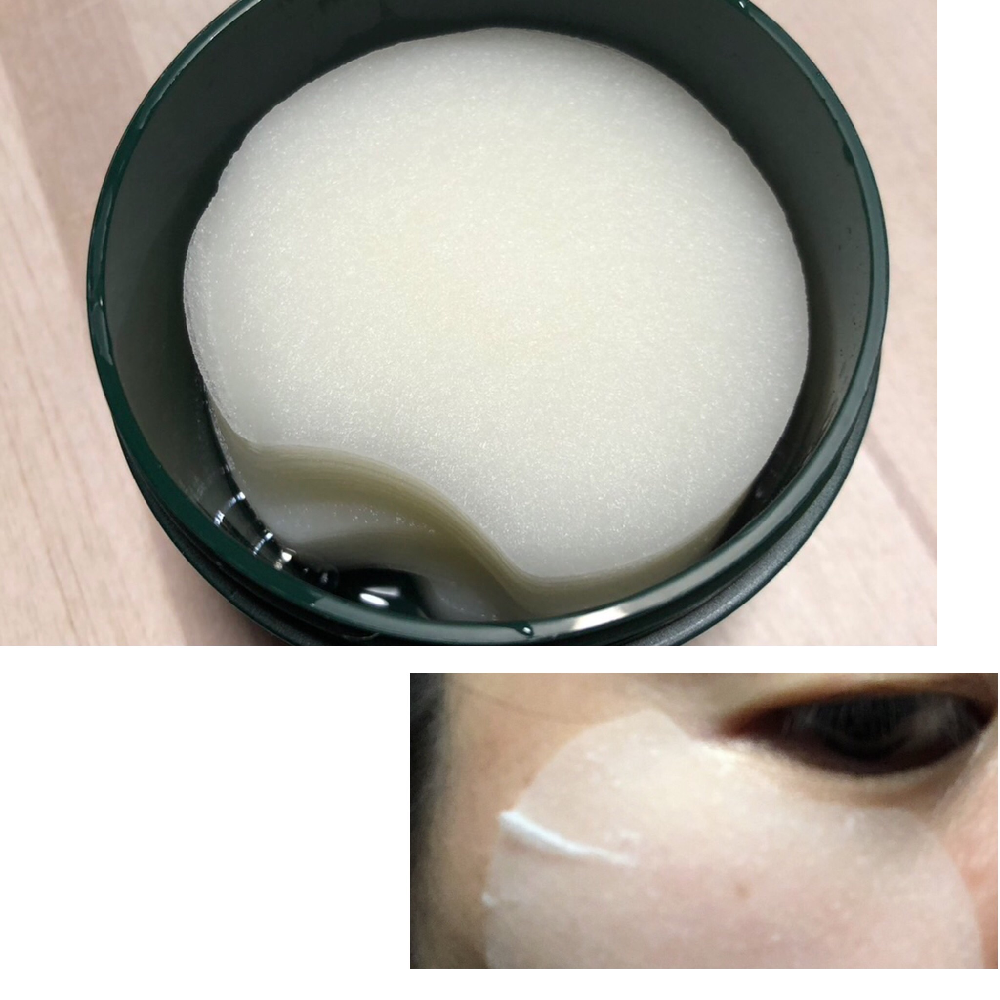 グリーンダーマCICAエッセンシャルパッド/ネイチャーリパブリック/トナーパッドを使ったクチコミ（2枚目）