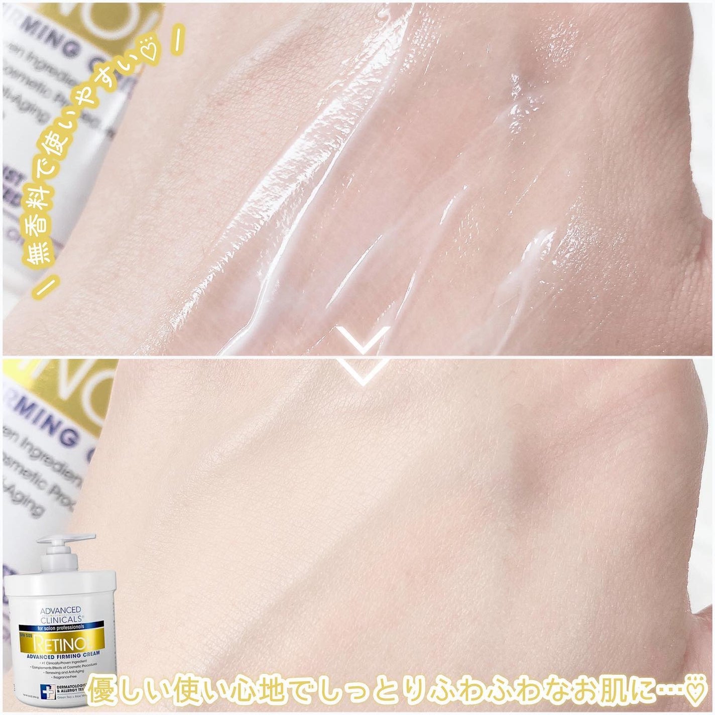 レチノールアドバンスドファーミングクリーム/ADVANCED CLINICALS/ボディクリームを使ったクチコミ(4枚目)
