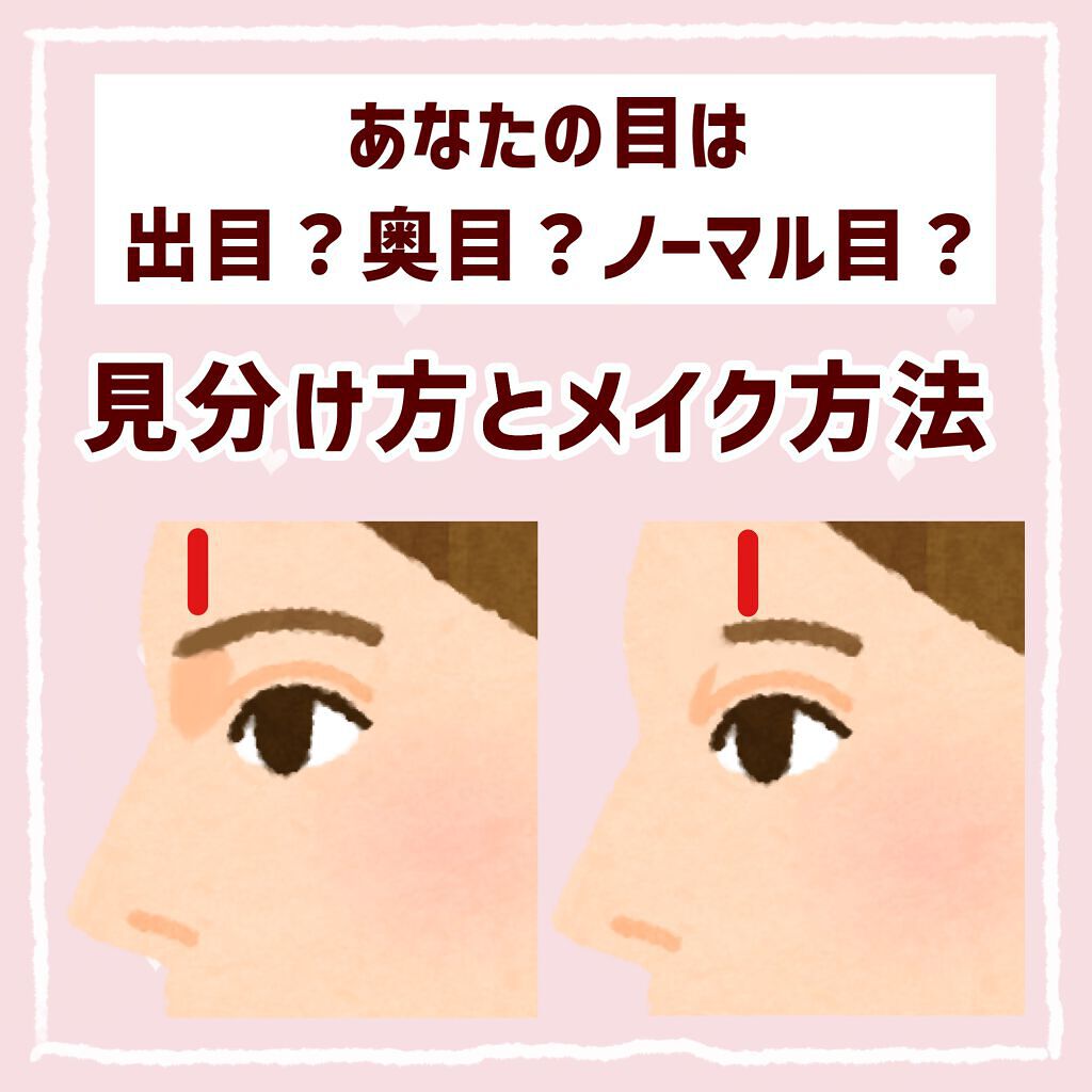 ひとえ・奥ぶたえ用カーラー/アイプチ®/ビューラーを使ったクチコミ（1枚目）