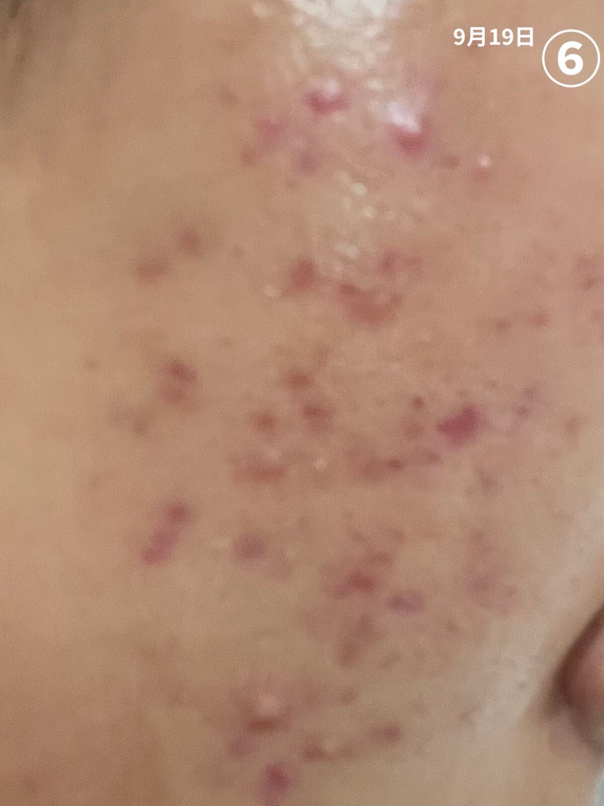 薬用しみ対策 美白化粧水/メラノCC/化粧水を使ったクチコミ(7枚目)