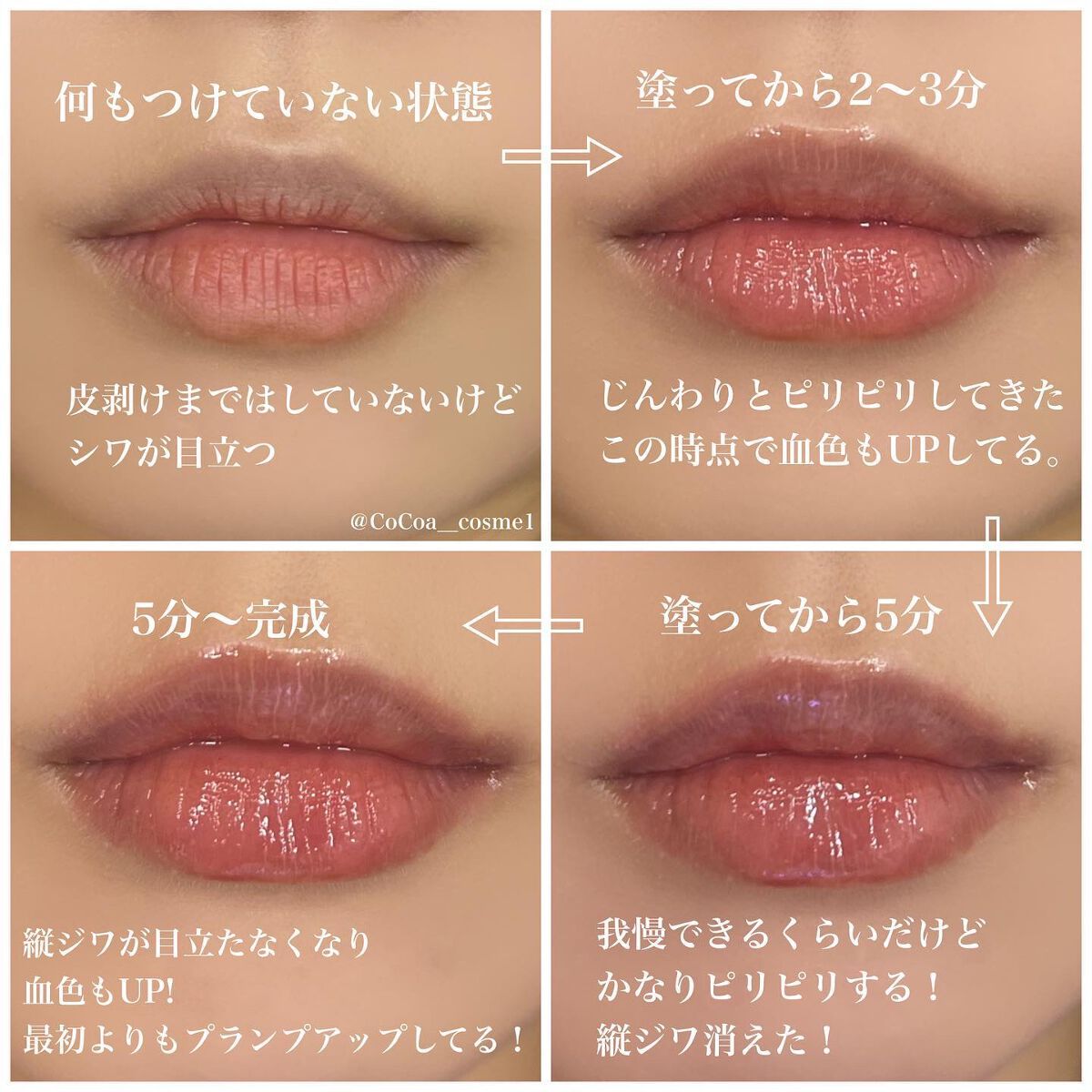 DEROLリッププランパー＆リップケアグロスセット/DEROL /リッププランパーを使ったクチコミ（2枚目）