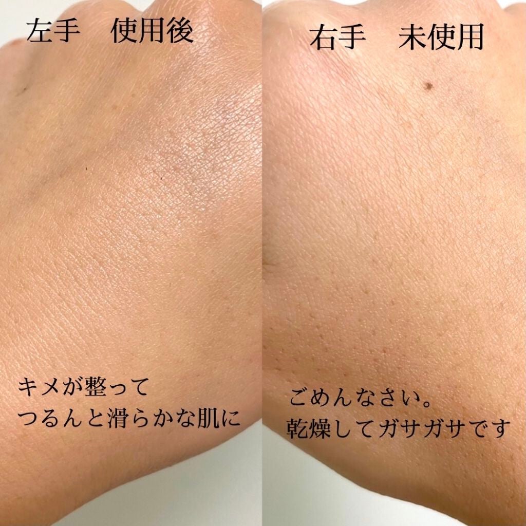 ガラクナイアシン2.0エッセンス/manyo/美容液を使ったクチコミ(2枚目)