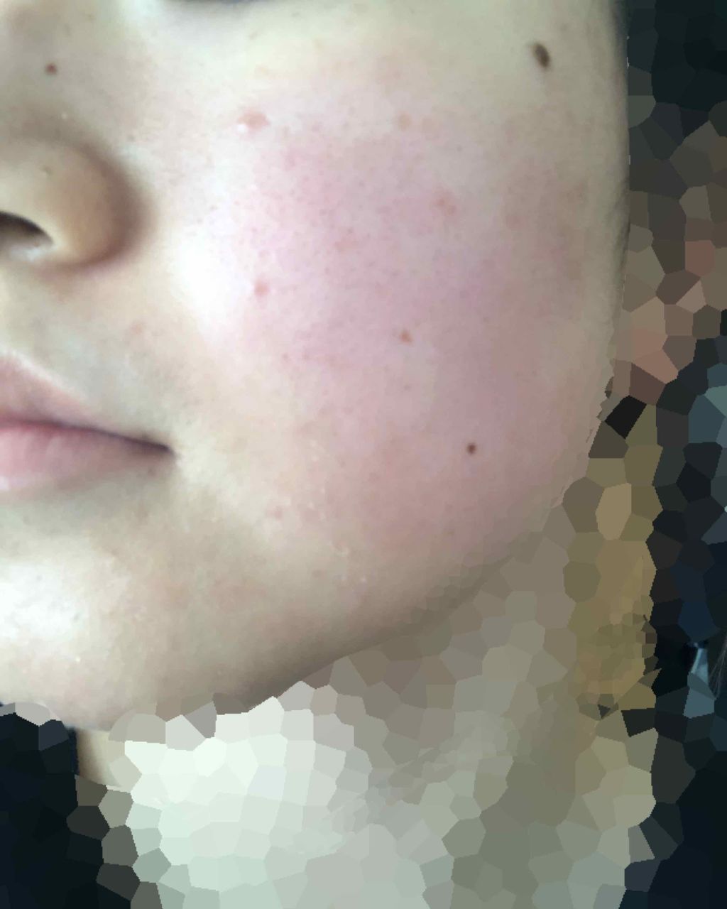 ハトムギ化粧水(ナチュリエ スキンコンディショナー R )/ナチュリエ/化粧水を使ったクチコミ(2枚目)