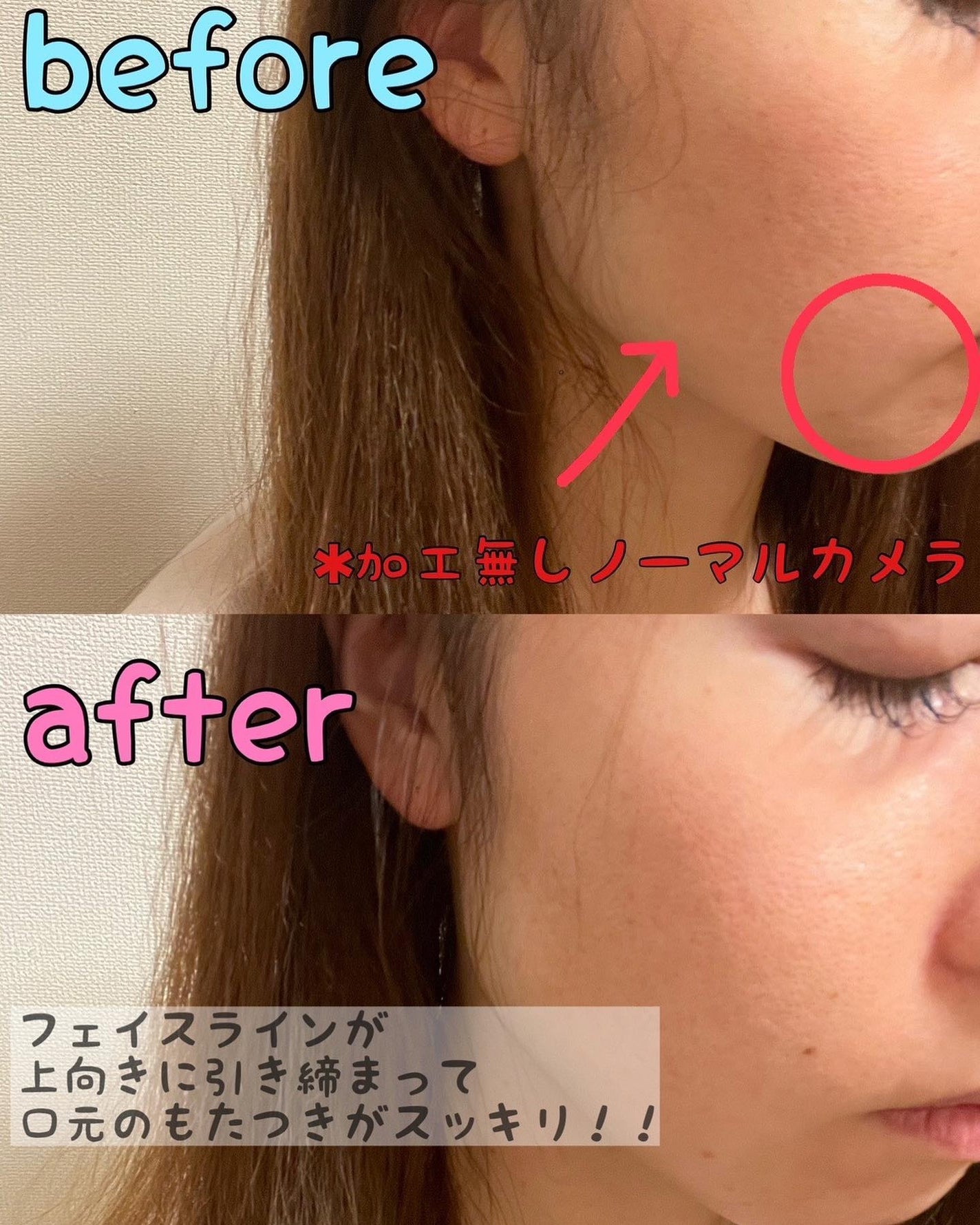 デンキブラシ モッサーモ/CBS cosmetics/ヘッドマッサージャーを使ったクチコミ(5枚目)