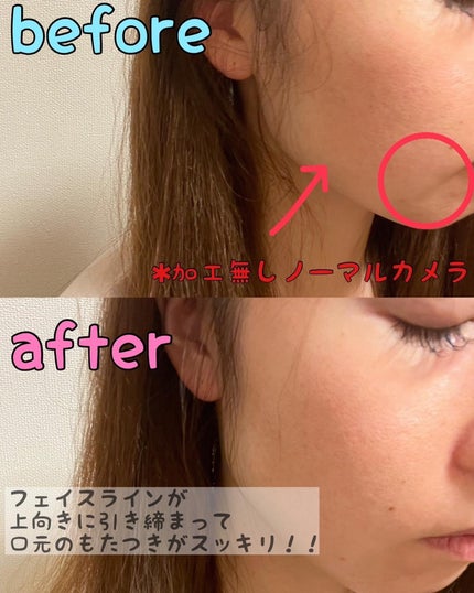 デンキブラシ モッサーモ/CBS cosmetics/ヘッドマッサージャーを使ったクチコミ(5枚目)