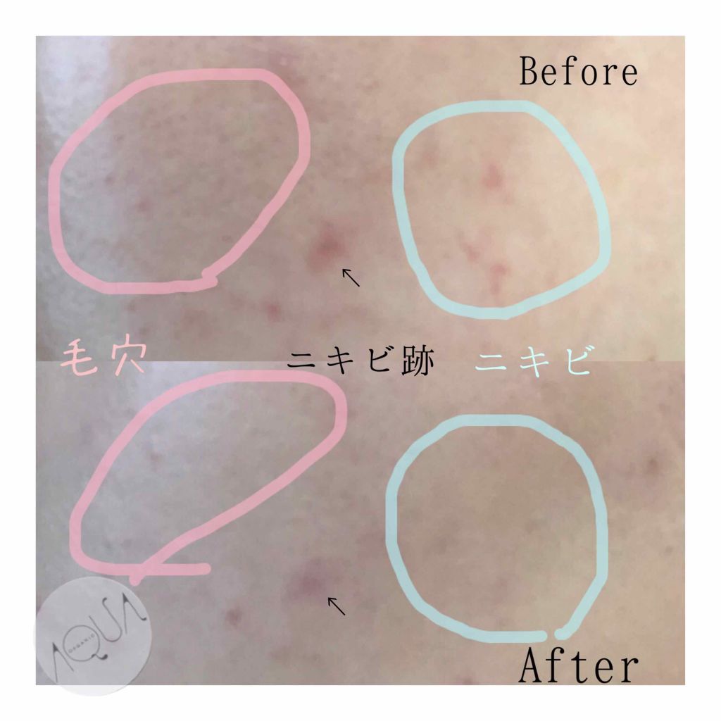 オーガニッククッションコンパクト/アクア・アクア/クッションファンデーションを使ったクチコミ(4枚目)