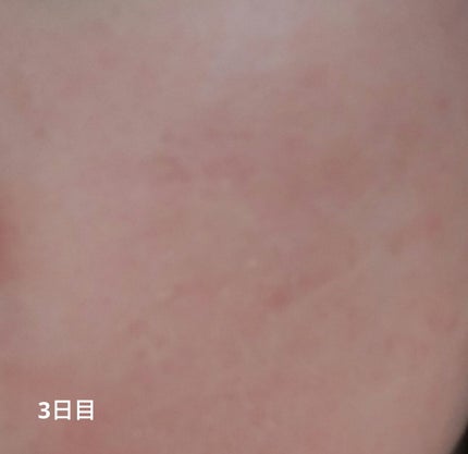 エクスフォリエーティング ポリッシュ/ZO Skin Health/スクラブ・ゴマージュを使ったクチコミ(3枚目)